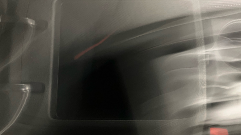 Kia Xceed 1.0T GDi ISG 2 5dr Petrol Hatchback